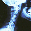 How I Dealt with a Massive Pain the Neck